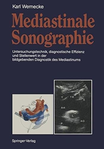 Mediastinale Sonographie Untersuchungstechnik, diagnostische Effizienz und Stellenwert in der bildgebenden Diagnostik des Mediastinums