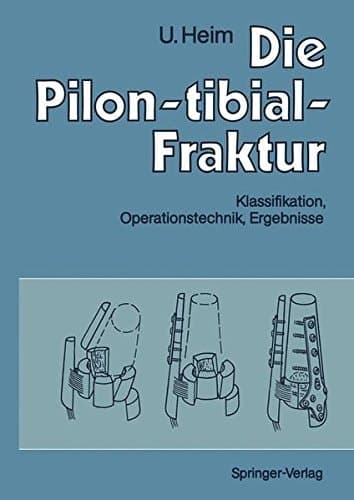 Die Pilon-tibial-Fraktur Klassifikation, Operationstechnik, Ergebnisse