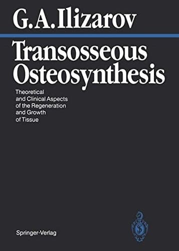 Transosseous Osteosynthesis Theoretical and Clinical Aspects of the Regeneration and Growth of Tissue