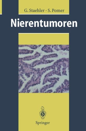 Nierentumoren Grundlagen, Diagnostik, Therapie