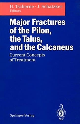 Major Fractures of the Pilon, the Talus, and the Calcaneus Current Concepts of Treatment
