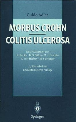 Morbus Crohn Colitis ulcerosa