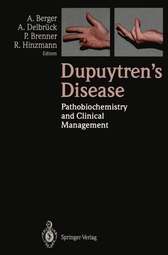 Dupuytren’s Disease Pathobiochemistry and Clinical Management