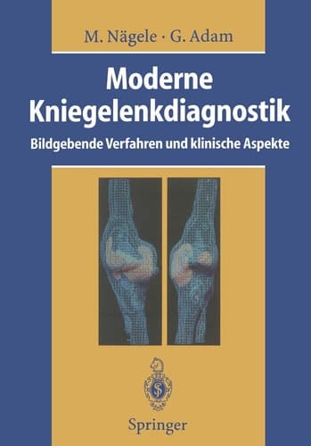 Moderne Kniegelenkdiagnostik Bildgebende Verfahren und klinische Aspekte