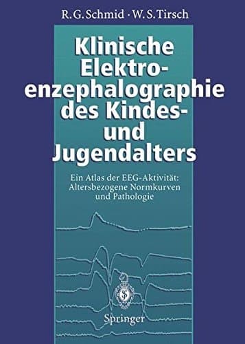 Klinische Elektroenzephalographie des Kindes- und Jugendalters Ein Atlas der EEG-Aktivität: Altersbezogene Normkurven und Pathologie