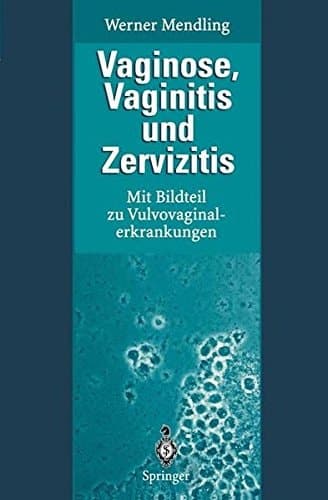 Vaginose, Vaginitis und Zervizitis mit Bildteil zu Vulvovaginalerkrankungen