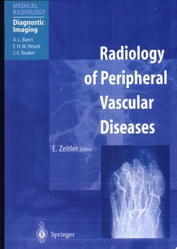Radiology of Peripheral Vascular Diseases With 198 Tables