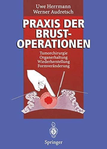 Praxis der Brustoperationen Tumorchirurgie - Organerhaltung ; Wiederherstellung - Formveränderung