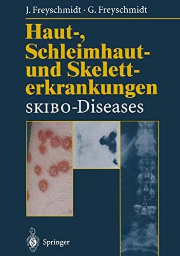 Haut-, Schleimhaut- und Skeletterkrankungen SKIBO-Diseases Eine dermatologische-klinisch-radiologische Synopse