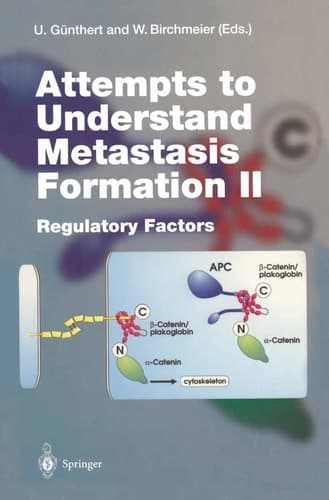 Attempts to Understand Metastasis Formation II Regulatory Factors