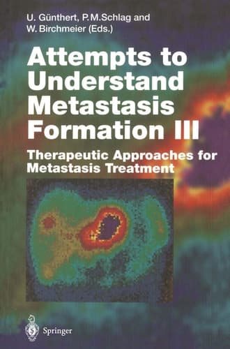 Attempts to Understand Metastasis Formation III Therapeutic Approaches for Metastasis Treatment
