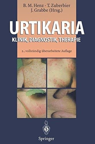 Urtikaria Klinik, Diagnostik, Therapie