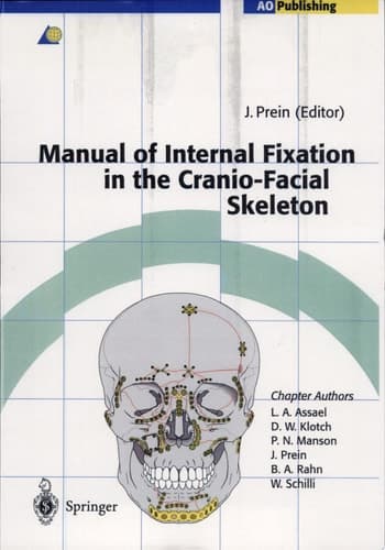 Manual of Internal Fixation in the Cranio-Facial Skeleton. Techniques as recommended by the AO/ASIF-Maxillofacial Group.