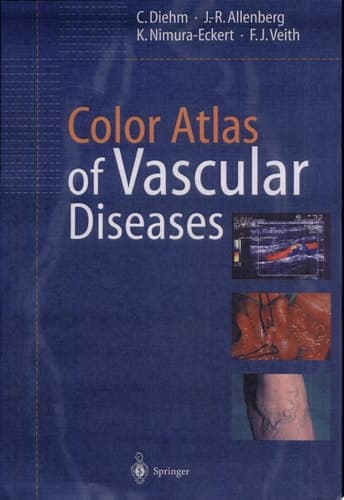 Color Atlas of Vascular Diseases