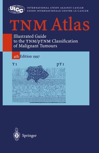 TNM Atlas: Illustrated Guide to the TNM/pTNM-Classification of Malignant Tumours