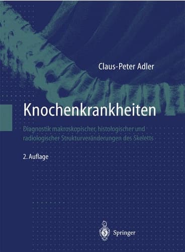 Knochenkrankheiten Diagnostik makroskopischer, histologischer und radiologischer Strukturveränderungen des Skeletts ; mit 6 Tabellen