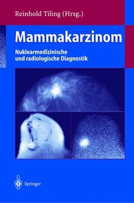 Mammakarzinom Nuklearmedizinische und radiologische Diagnostik