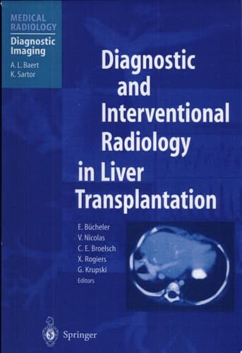 Diagnostic and Interventional Radiology in Liver Transplantation
