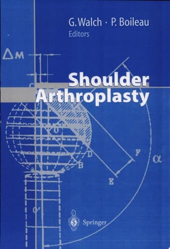 Shoulder Arthroplasty