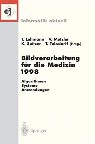 Bildverarbeitung für die Medizin 1998 Algorithmen — Systeme — Anwendungen Proceedings des Workshops am 26. und 27. März 1998 in Aachen