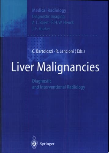 Liver Malignancies Diagnostic and Interventional Radiology