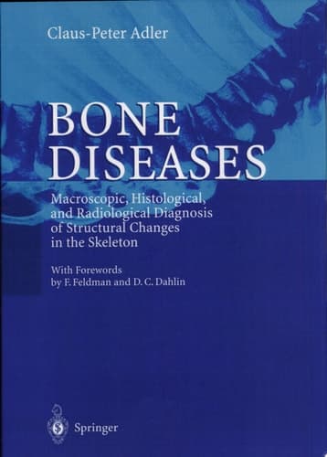 Bone Diseases Macroscopic, Histological, and Radiological Diagnosis of Structural Changes in the Skeleton