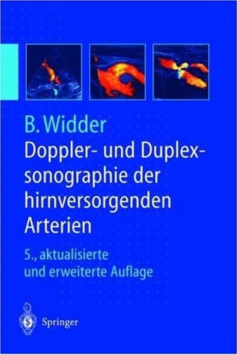 Doppler- und Duplexsonographie der hirnversorgenden Arterien