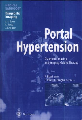 Portal Hypertension Diagnostic Imaging and Imaging-guided Therapy ; with 49 Tables
