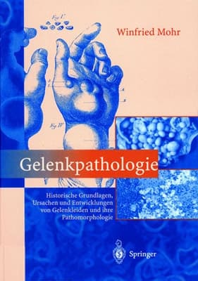 Gelenkpathologie Historische Grundlagen, Ursachen und Entwicklungen von Gelenkleiden und ihre Pathomorphologie