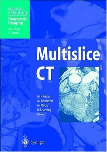 Multislice CT