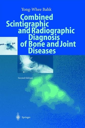 Combined Scintigraphic and Radiographic Diagnosis of Bone and Joint Diseases