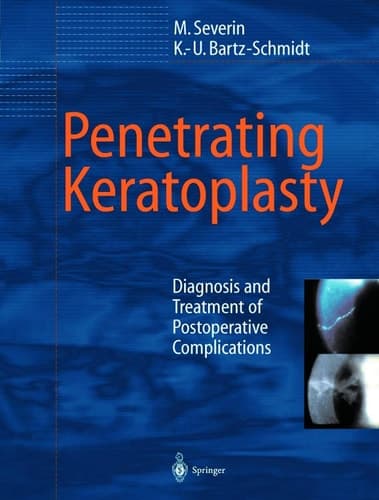 Penetrating Keratoplasty Diagnosis and Treatment of Postoperative Complications
