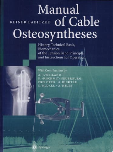 Manual of Cable Osteosyntheses History, Technical Basis, Biomechanics of the Tension Band Principle, and Instructions for Operation