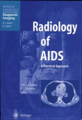 Radiology of AIDS