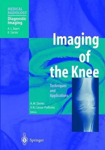 Imaging of the Knee: Techniques and Applications (Medical Radiology / Diagnostic Imaging)