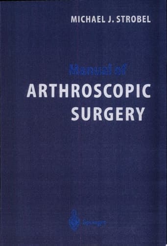 Manual of Arthroscopic Surgery