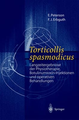 Torticollis spasmodicus Langzeitergebnisse der Physiotherapie, Botulinumtoxin-Injektionen und operativen Behandlungen