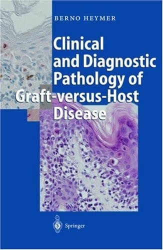 Clinical and Diagnostic Pathology of Graft-versus-Host Disease