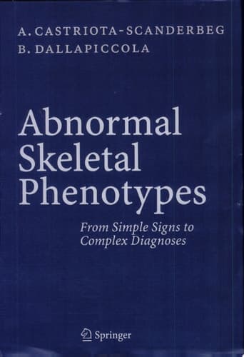 Abnormal Skeletal Phenotypes From Simple Signs to Complex Diagnoses