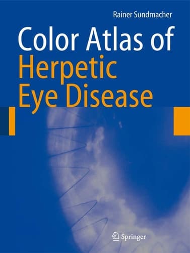 Color Atlas of Herpetic Eye Disease A Practical Guide to Clinical Management