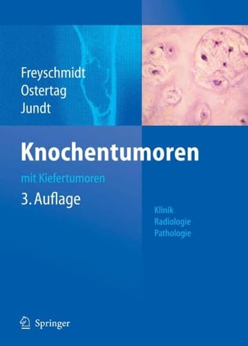 Knochentumoren mit Kiefertumoren Klinik - Radiologie - Pathologie