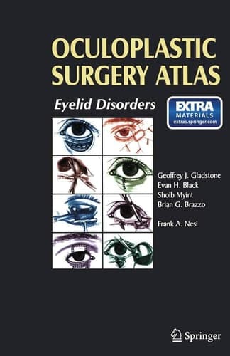 Oculoplastic Surgery Atlas Eyelid Disorders