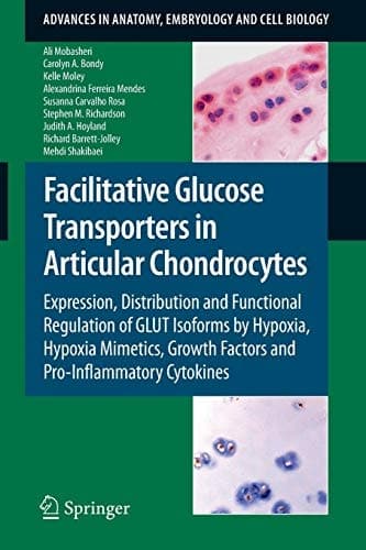 Facilitative Glucose Transporters in Articular Chondrocytes Expression, Distribution and Functional Regulation of GLUT Isoforms by Hypoxia, Hypoxia Mimetics, Growth Factors and Pro-Inflammatory Cytokines