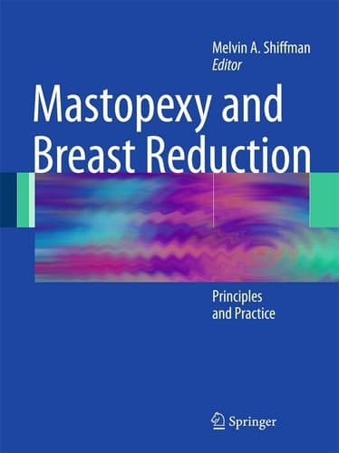 Mastopexy and Breast Reduction Principles and Practice