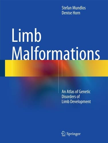 Limb Malformations An Atlas of Genetic Disorders of Limb Development