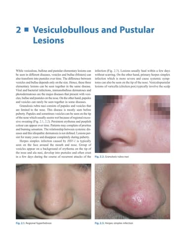 Dermatological Diseases of the Nose and Ears An Illustrated Guide