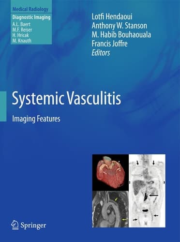 Systemic Vasculitis Imaging Features