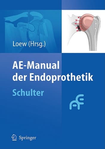 AE-Manual der Endoprothetik Schulter