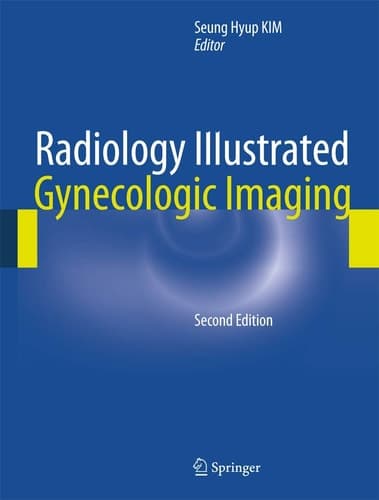 Radiology Illustrated: Gynecologic Imaging