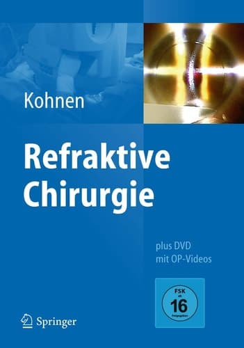 Refraktive Chirurgie (German Edition)